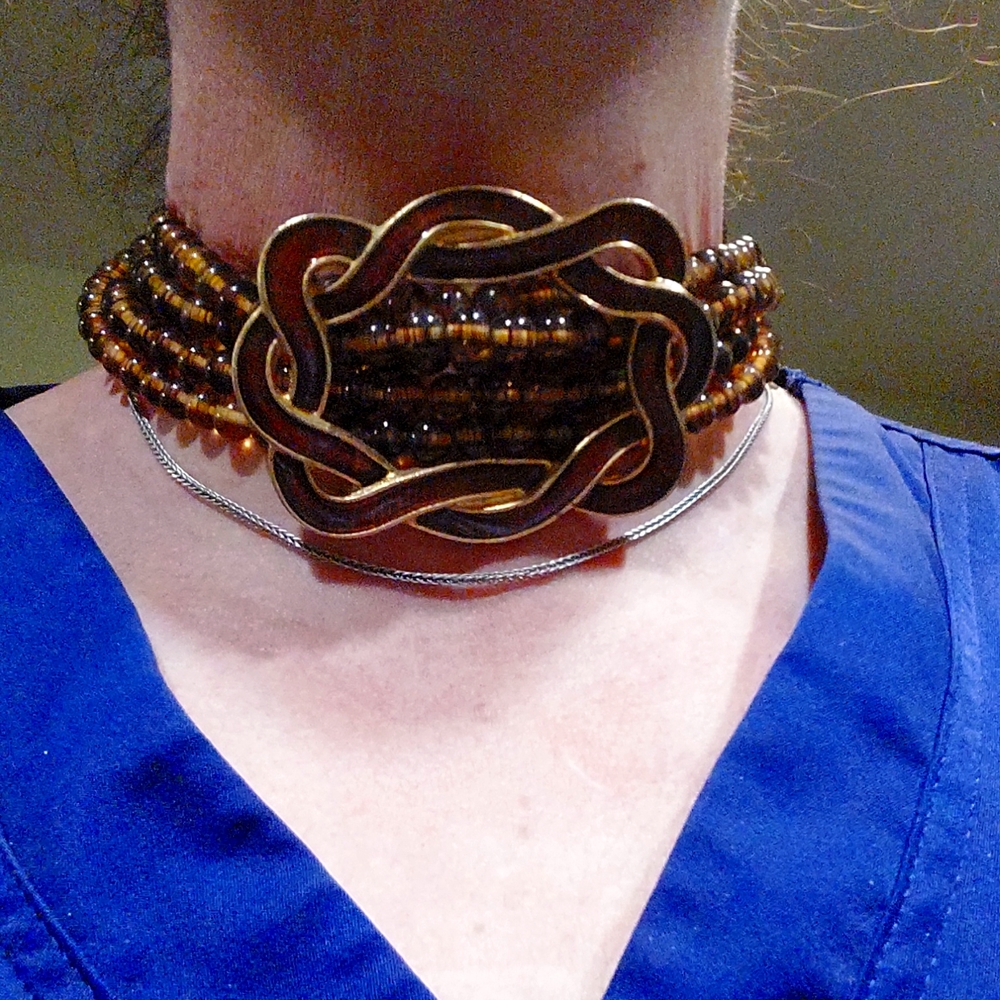 Jay Feinberg chocker